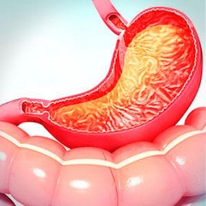 Tips para controlar la gastritis