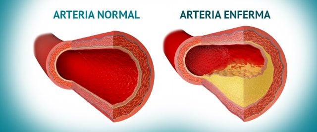 arterias